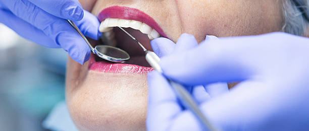 Best Knocked-Out Tooth Emergency  in Hallandale Beach, FL